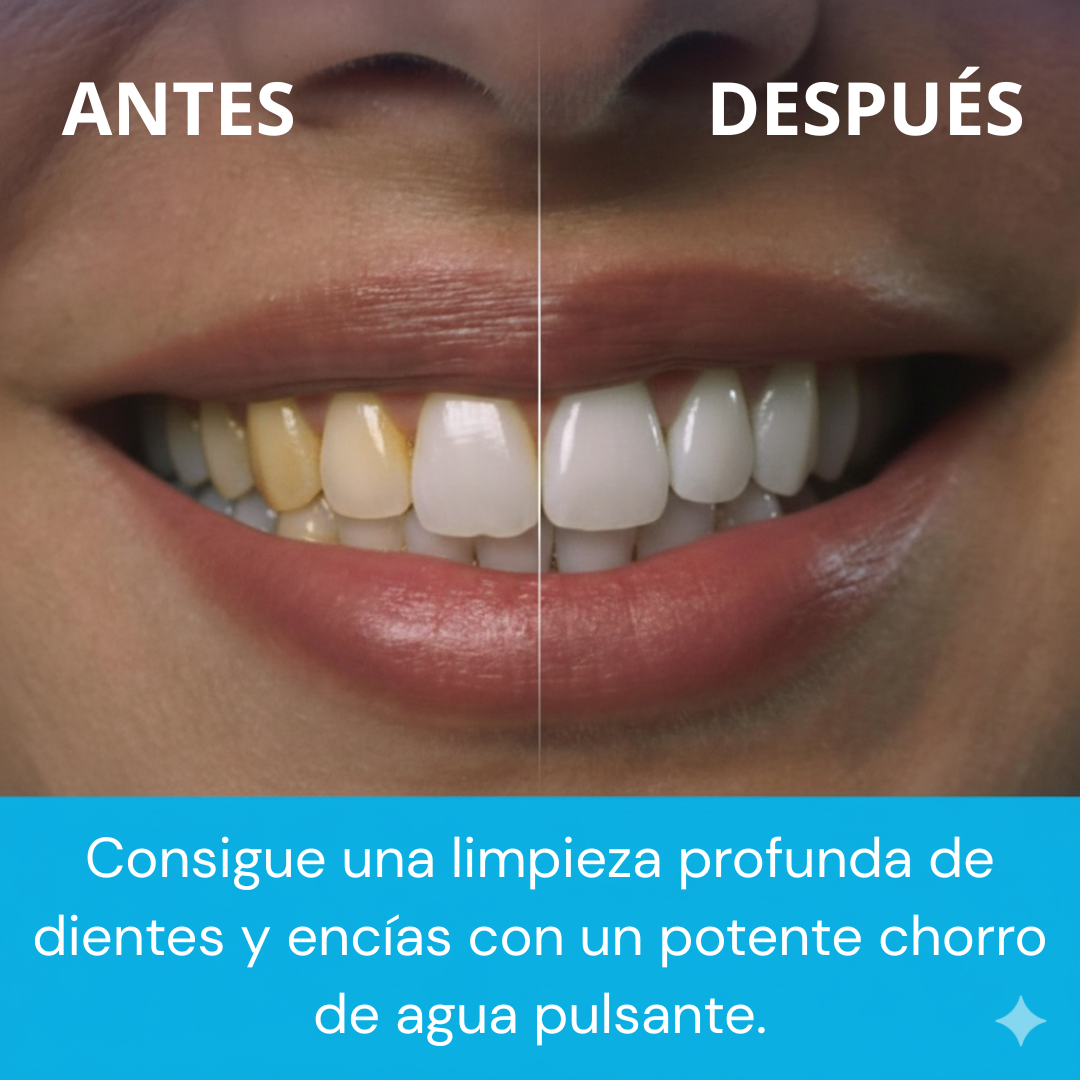 AquaClean Pro® - Irrigador Bucal - ¡Limpia donde el Cepillo no llega!